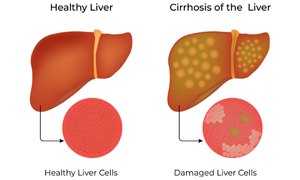 best-gastroenterology-hospital-kerala