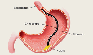 Best Gastroenterologist in Kerala