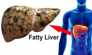 Best Gastroenterologist in Kerala