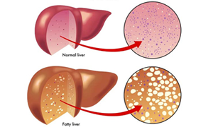 best-gastroenterology-hospital-kerala